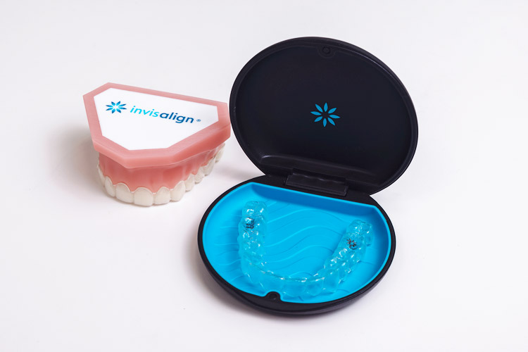 マウスピース矯正のイメージ写真