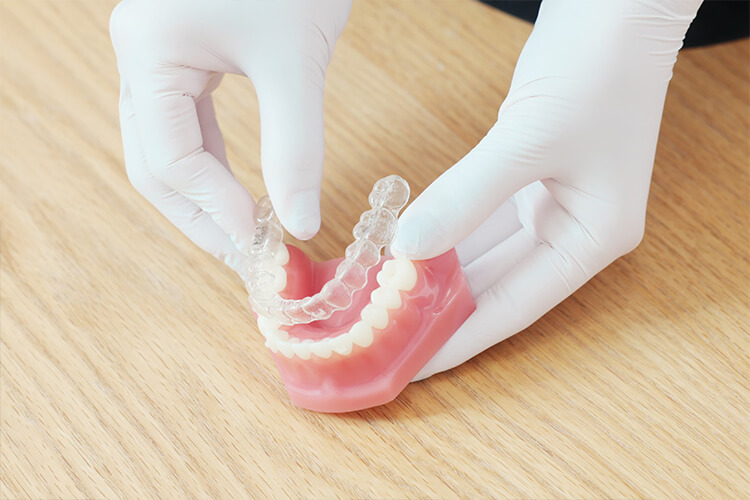 マウスピース矯正のイメージ写真