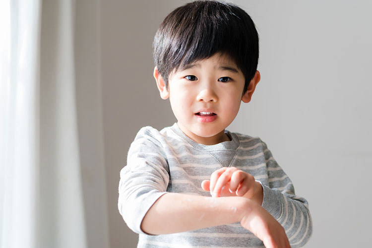 アレルギーフリー