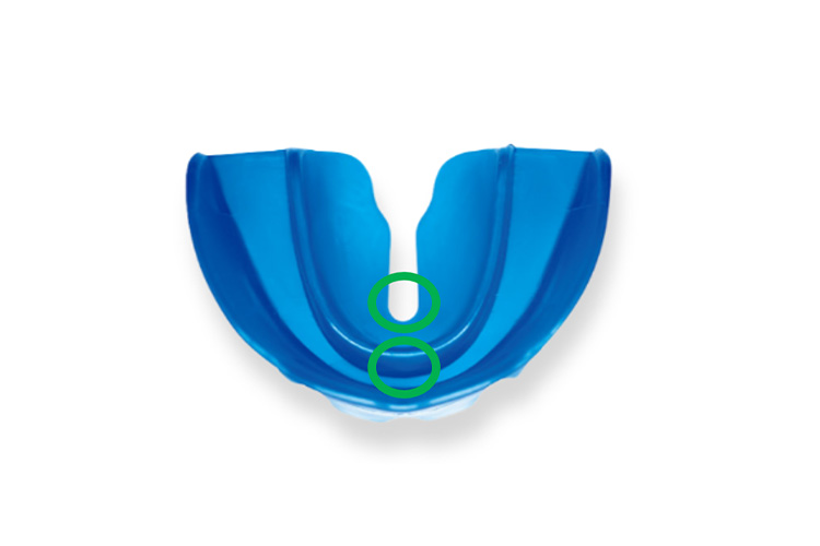 プレオルソのイメージ写真