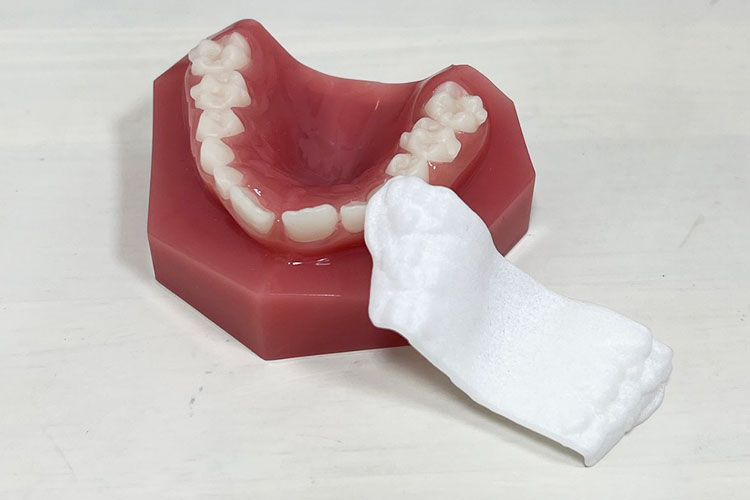 お子さまの矯正治療に新しいソリューションが登場のインビザライン・パラタル・エクスパンダーイメージ写真